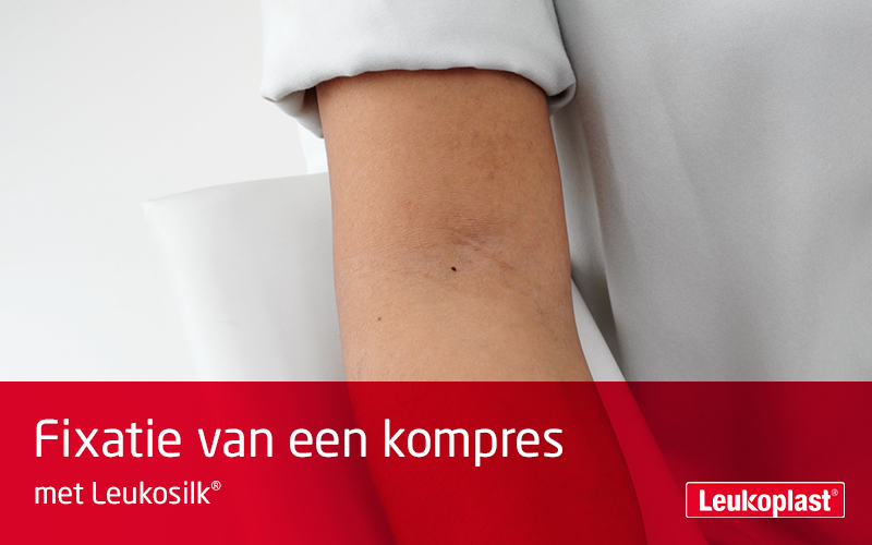 Hier kunnen we in close-up zien hoe een kompres wordt gefixeerd met een hechtpleister voor de gevoelige huid: de handen van een zorgverlener brengen een kompres aan op de elleboogholte van een patiënt met Leukosilk. Hier kunnen we in close-up zien hoe een kompres wordt gefixeerd met een hechtpleister voor de gevoelige huid: de handen van een zorgverlener brengen een kompres aan op de elleboogholte van een patiënt met Leukosilk.